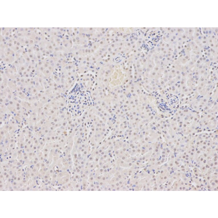 Immunohistochemistry - DCK Antibody from Signalway Antibody (32437) - Antibodies.com