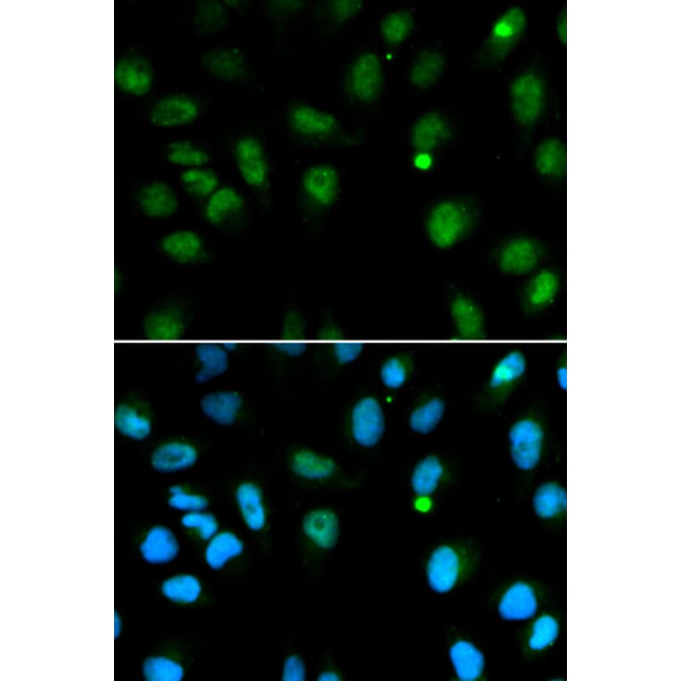 Immunofluorescence - DCK Antibody from Signalway Antibody (32437) - Antibodies.com