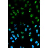 Immunofluorescence - DCK Antibody from Signalway Antibody (32437) - Antibodies.com
