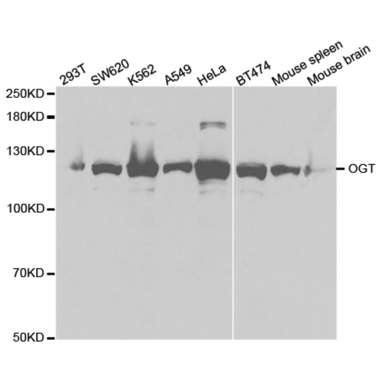 Western blot - OGT Antibody from Signalway Antibody (32540) - Antibodies.com