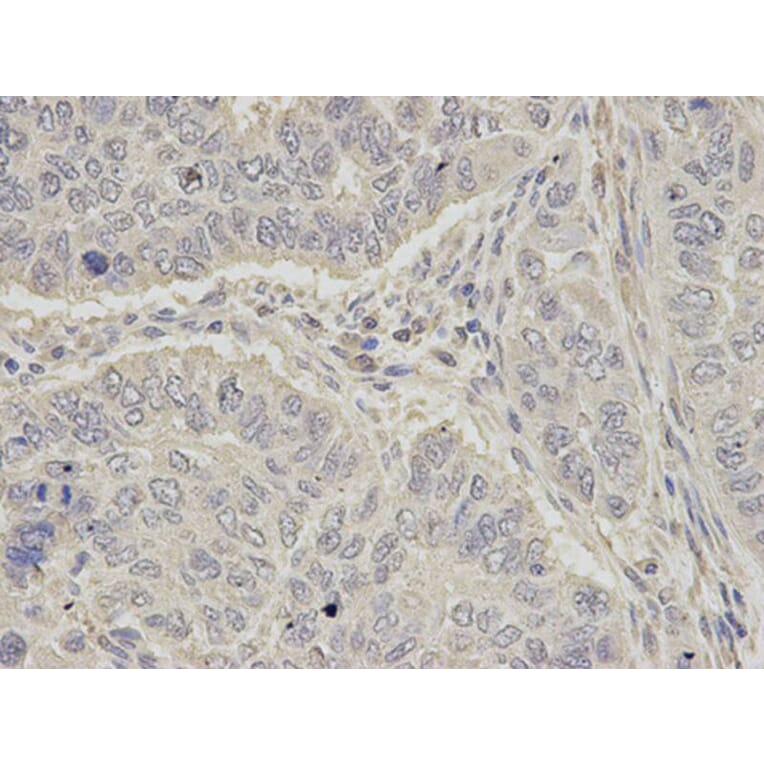 Immunohistochemistry - OGT Antibody from Signalway Antibody (32540) - Antibodies.com