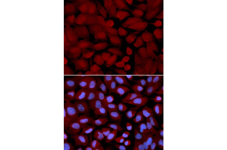 Immunofluorescence - OGT Antibody from Signalway Antibody (32540) - Antibodies.com