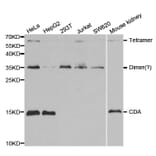 Western blot - CDA Antibody from Signalway Antibody (32548) - Antibodies.com