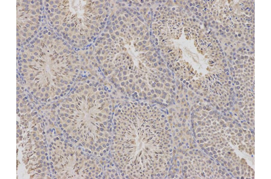 Immunohistochemistry - CDA Antibody from Signalway Antibody (32548) - Antibodies.com