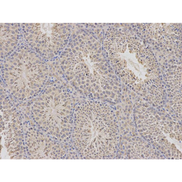 Immunohistochemistry - CDA Antibody from Signalway Antibody (32548) - Antibodies.com