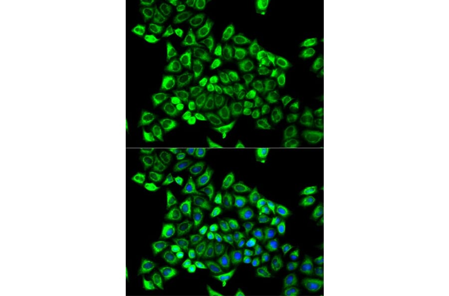 Immunofluorescence - CDA Antibody from Signalway Antibody (32548) - Antibodies.com