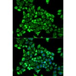 Immunofluorescence - CDA Antibody from Signalway Antibody (32548) - Antibodies.com