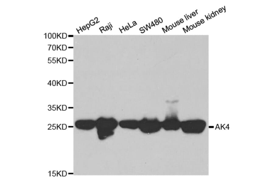 Western blot - AK4 Antibody from Signalway Antibody (32571) - Antibodies.com