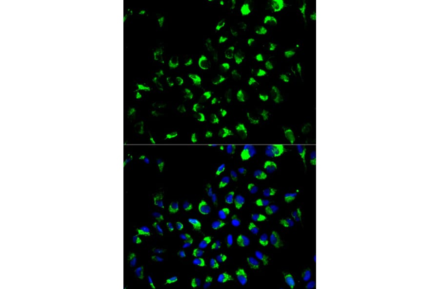 Immunofluorescence - AK4 Antibody from Signalway Antibody (32571) - Antibodies.com
