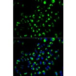 Immunofluorescence - AK4 Antibody from Signalway Antibody (32571) - Antibodies.com