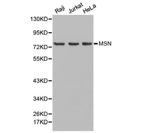 Western blot - MSN Antibody from Signalway Antibody (32645) - Antibodies.com