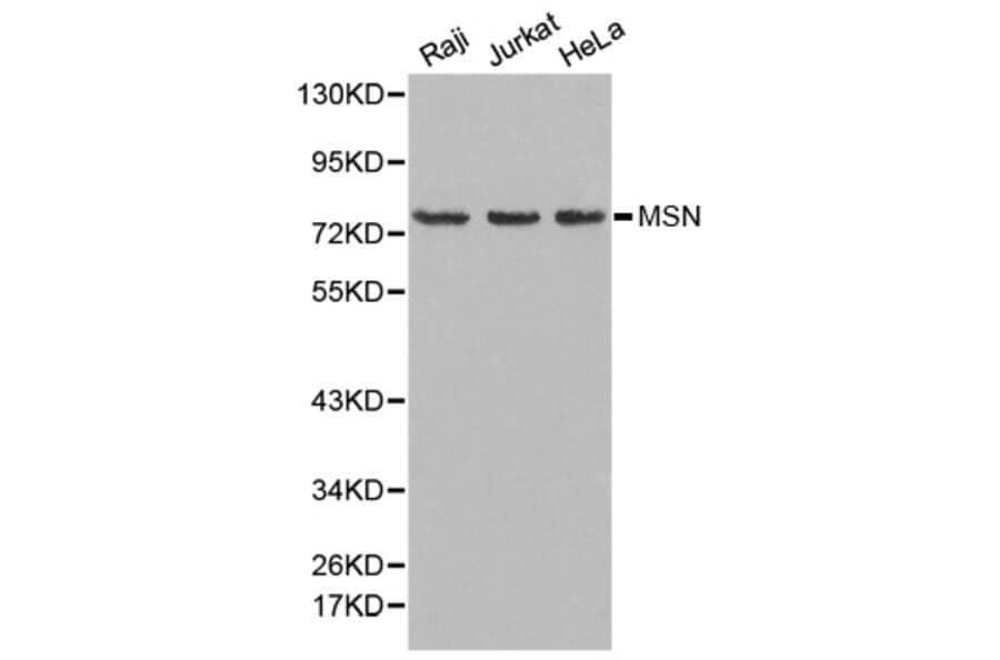 Western blot - MSN Antibody from Signalway Antibody (32645) - Antibodies.com