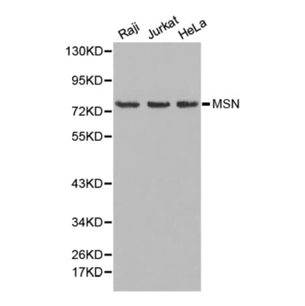 Western blot - MSN Antibody from Signalway Antibody (32645) - Antibodies.com