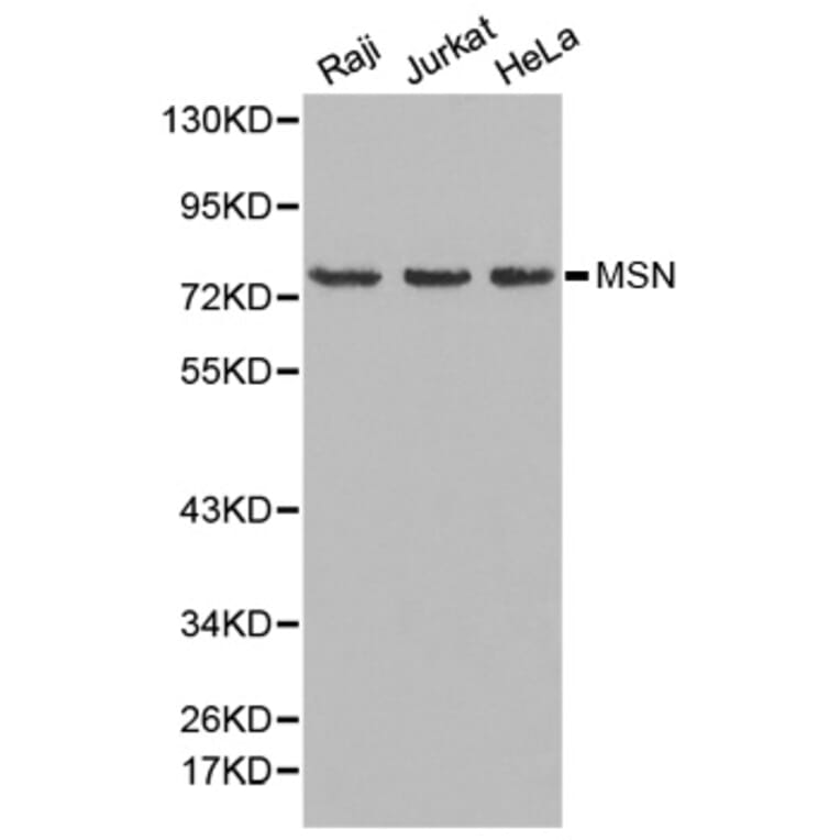 Western blot - MSN Antibody from Signalway Antibody (32645) - Antibodies.com