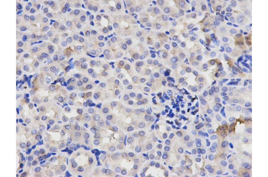 Immunohistochemistry - p65 Antibody from Signalway Antibody (32705) - Antibodies.com