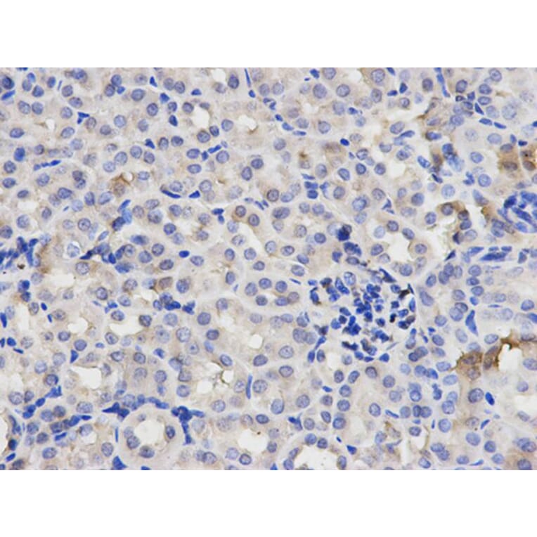 Immunohistochemistry - p65 Antibody from Signalway Antibody (32705) - Antibodies.com