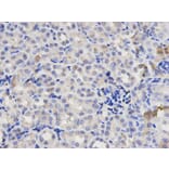 Immunohistochemistry - p65 Antibody from Signalway Antibody (32705) - Antibodies.com