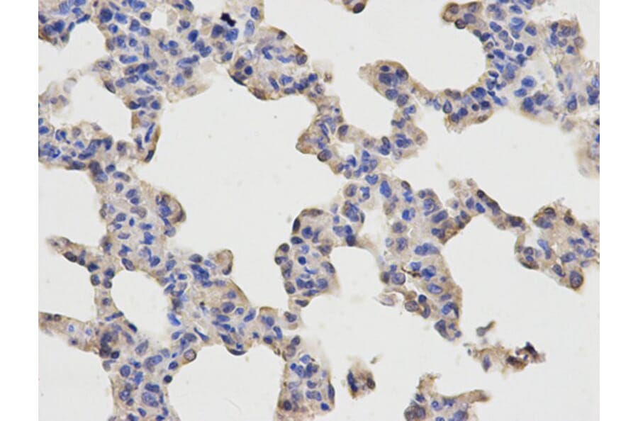 Immunohistochemistry - p65 Antibody from Signalway Antibody (32705) - Antibodies.com