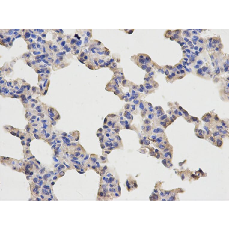 Immunohistochemistry - p65 Antibody from Signalway Antibody (32705) - Antibodies.com