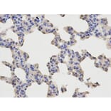 Immunohistochemistry - p65 Antibody from Signalway Antibody (32705) - Antibodies.com