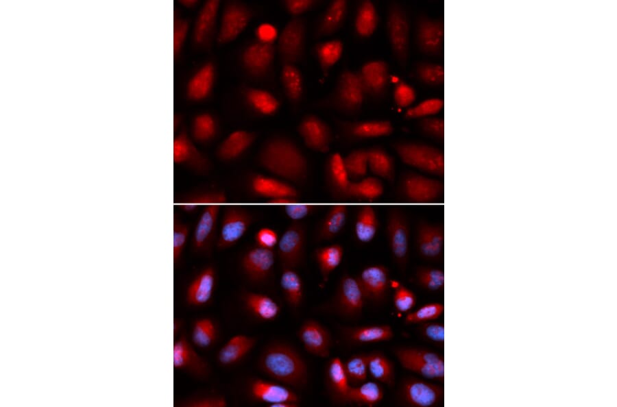 Immunofluorescence - p65 Antibody from Signalway Antibody (32705) - Antibodies.com