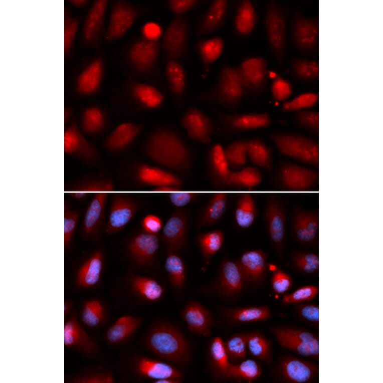 Immunofluorescence - p65 Antibody from Signalway Antibody (32705) - Antibodies.com