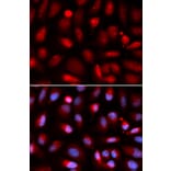 Immunofluorescence - p65 Antibody from Signalway Antibody (32705) - Antibodies.com