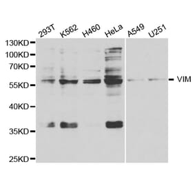 Western blot - VIM Antibody from Signalway Antibody (32733) - Antibodies.com