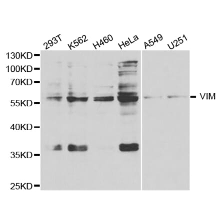 Western blot - VIM Antibody from Signalway Antibody (32733) - Antibodies.com
