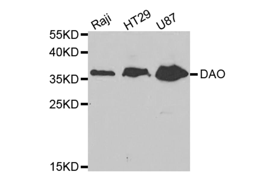 Western blot - DAO Antibody from Signalway Antibody (32763) - Antibodies.com