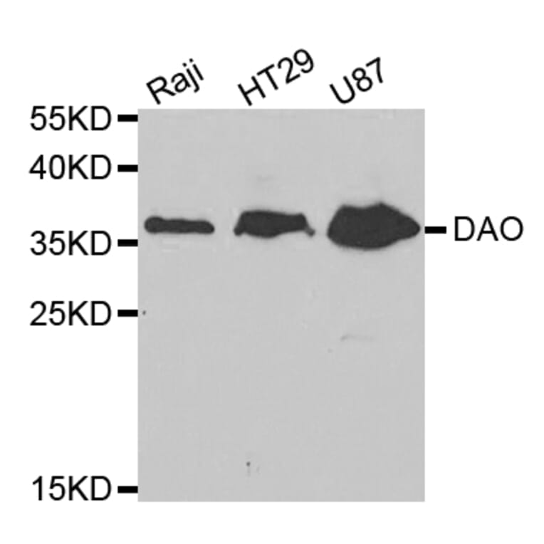 Western blot - DAO Antibody from Signalway Antibody (32763) - Antibodies.com