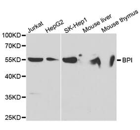 Western blot - BPI Antibody from Signalway Antibody (32782) - Antibodies.com