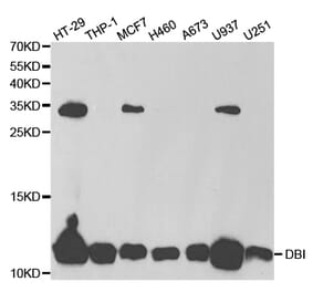 Western blot - DBI Antibody from Signalway Antibody (32810) - Antibodies.com