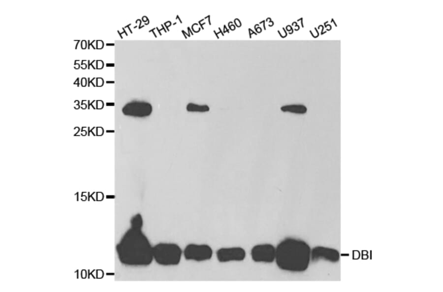 Western blot - DBI Antibody from Signalway Antibody (32810) - Antibodies.com