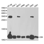 Western blot - DBI Antibody from Signalway Antibody (32810) - Antibodies.com
