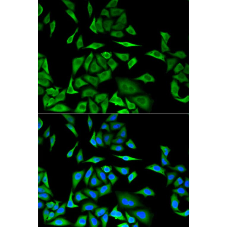 Immunofluorescence - DBI Antibody from Signalway Antibody (32810) - Antibodies.com