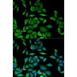Immunofluorescence - DBI Antibody from Signalway Antibody (32810) - Antibodies.com