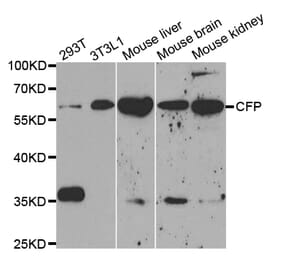 Western blot - CFP Antibody from Signalway Antibody (32828) - Antibodies.com