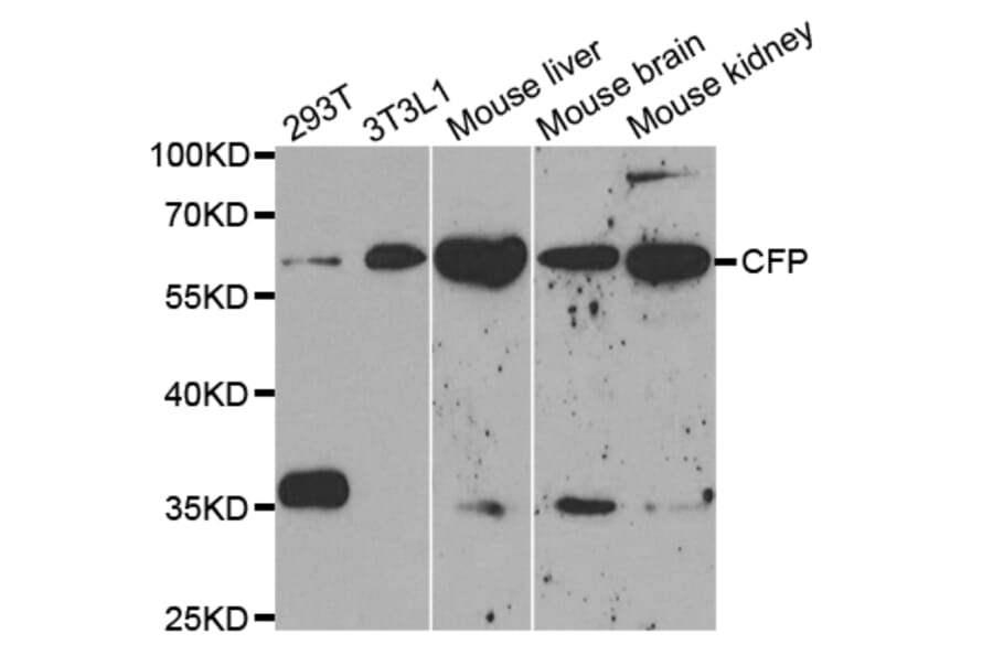 Western blot - CFP Antibody from Signalway Antibody (32828) - Antibodies.com