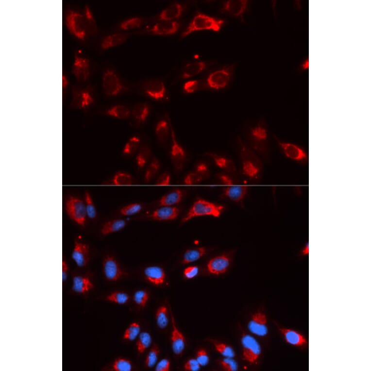 Immunofluorescence - CFP Antibody from Signalway Antibody (32828) - Antibodies.com