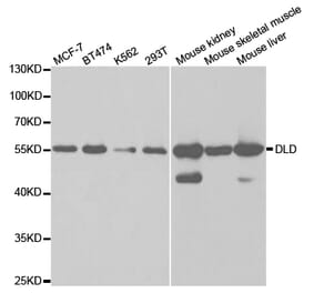 Western blot - DLD Antibody from Signalway Antibody (32831) - Antibodies.com