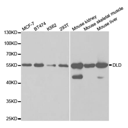 Western blot - DLD Antibody from Signalway Antibody (32831) - Antibodies.com