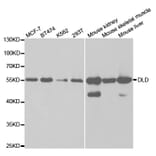 Western blot - DLD Antibody from Signalway Antibody (32831) - Antibodies.com