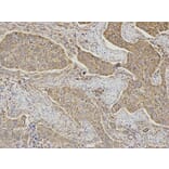 Immunohistochemistry - DLD Antibody from Signalway Antibody (32831) - Antibodies.com