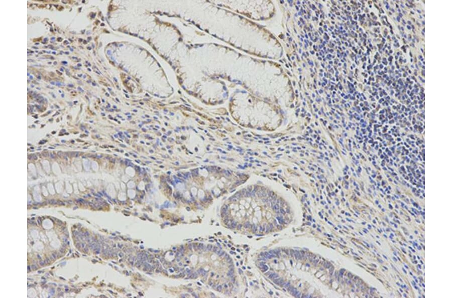Immunohistochemistry - DLD Antibody from Signalway Antibody (32831) - Antibodies.com