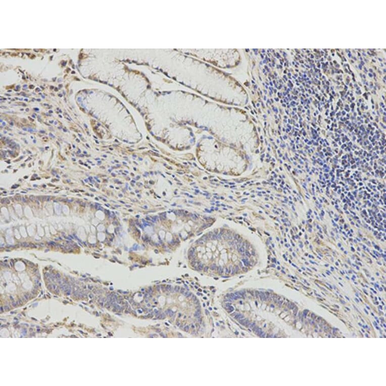 Immunohistochemistry - DLD Antibody from Signalway Antibody (32831) - Antibodies.com