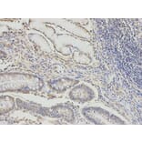 Immunohistochemistry - DLD Antibody from Signalway Antibody (32831) - Antibodies.com