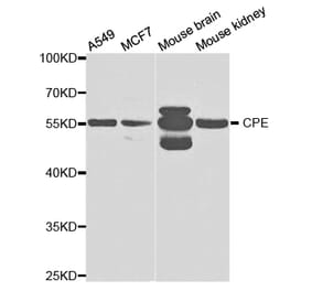 Western blot - CPE Antibody from Signalway Antibody (32861) - Antibodies.com