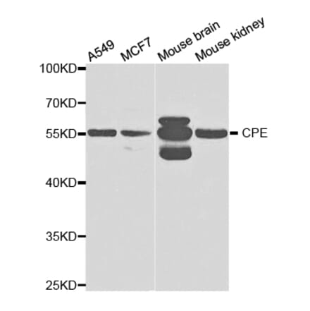 Western blot - CPE Antibody from Signalway Antibody (32861) - Antibodies.com