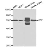 Western blot - CPE Antibody from Signalway Antibody (32861) - Antibodies.com